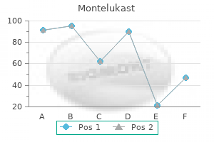 purchase montelukast 4mg overnight delivery