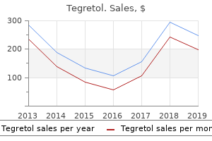 cheap 400 mg tegretol mastercard