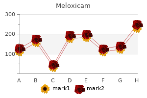 meloxicam 7.5 mg without a prescription
